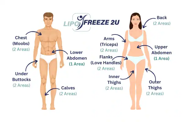 Areas you can have fat freezing treatment East Sussex