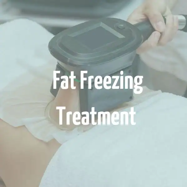 fat freezing treatment East Sussex