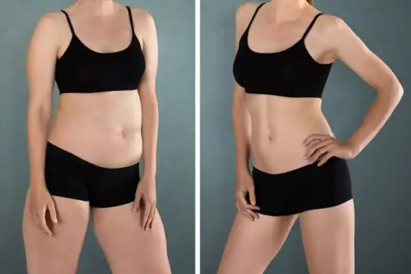 Are There Any Side Effects or Risks to Consider East Sussex?