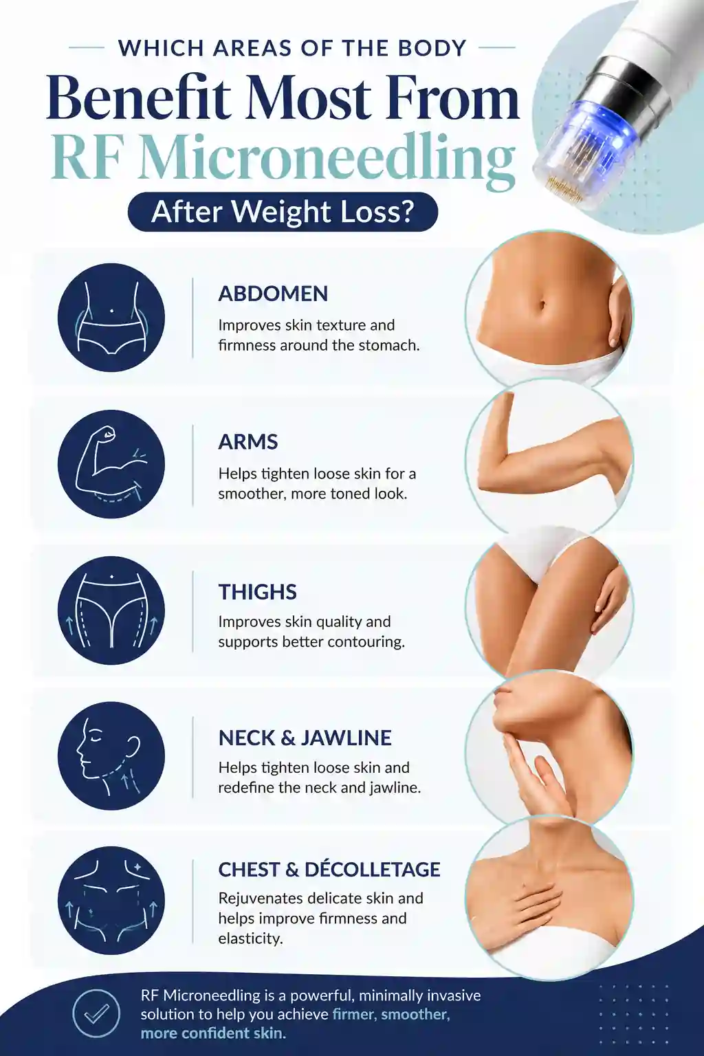 Which Areas of the Body Benefit Most From RF Microneedling After Weight Loss East Sussex